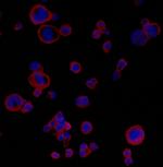 PD-L1 Antibody in Immunocytochemistry (ICC/IF)