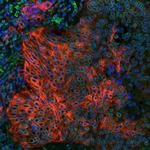 PD-L1 Antibody in Immunohistochemistry (Paraffin) (IHC (P))