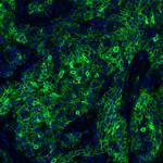 PD-L1 Antibody in Immunohistochemistry (Paraffin) (IHC (P))