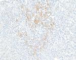 PD-L1 Antibody in Immunohistochemistry (Paraffin) (IHC (P))