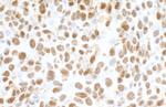 FUS Antibody in Immunohistochemistry (Paraffin) (IHC (P))