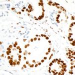 FUS Antibody in Immunohistochemistry (Paraffin) (IHC (P))