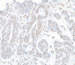 hSET1 Antibody in Immunohistochemistry (Paraffin) (IHC (P))