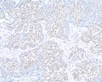 hSET1 Antibody in Immunohistochemistry (Paraffin) (IHC (P))