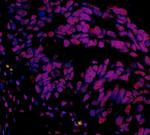 hSET1 Antibody in Immunohistochemistry (Paraffin) (IHC (P))