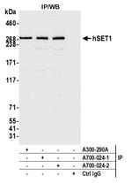 hSET1 Antibody in Immunoprecipitation (IP)