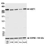 hSET1 Antibody in Western Blot (WB)