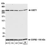 hSET1 Antibody in Western Blot (WB)