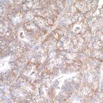 B7-H3/CD276 Antibody in Immunohistochemistry (Paraffin) (IHC (P))