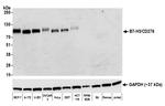 B7-H3/CD276 Antibody in Western Blot (WB)