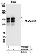 CEACAM1 Antibody in Immunoprecipitation (IP)