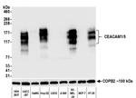 CEACAM1 Antibody in Western Blot (WB)