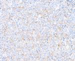 TIM3 Antibody in Immunohistochemistry (Paraffin) (IHC (P))