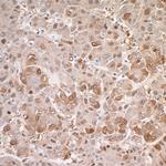 Arginase 1 Antibody in Immunohistochemistry (Paraffin) (IHC (P))