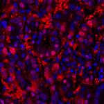 Arginase 1 Antibody in Immunohistochemistry (Paraffin) (IHC (P))