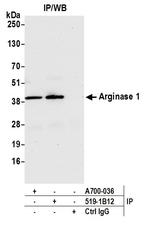 Arginase 1 Antibody in Immunoprecipitation (IP)