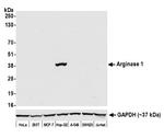 Arginase 1 Antibody in Western Blot (WB)