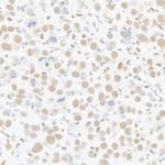 MED1 Antibody in Immunohistochemistry (Paraffin) (IHC (P))