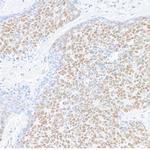 MED1 Antibody in Immunohistochemistry (Paraffin) (IHC (P))