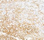 CD44 Antibody in Immunohistochemistry (Paraffin) (IHC (P))