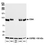 CD44 Antibody in Western Blot (WB)