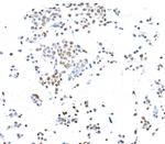 CTCF Antibody in Immunocytochemistry (ICC/IF)