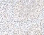 CTCF Antibody in Immunohistochemistry (Paraffin) (IHC (P))