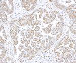 CTCF Antibody in Immunohistochemistry (Paraffin) (IHC (P))