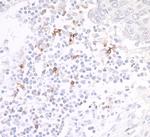 OX40/CD134 Antibody in Immunohistochemistry (Paraffin) (IHC (P))