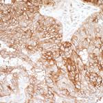 B7-H4 Antibody in Immunohistochemistry (Paraffin) (IHC (P))