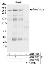 Senataxin Antibody in Immunoprecipitation (IP)