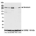 Senataxin Antibody in Western Blot (WB)