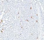 CD30 Antibody in Immunohistochemistry (Paraffin) (IHC (P))