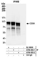 CD30 Antibody in Immunoprecipitation (IP)