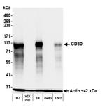 CD30 Antibody in Western Blot (WB)