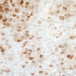 NAMPT/PBEF/Visfatin Antibody in Immunohistochemistry (Paraffin) (IHC (P))