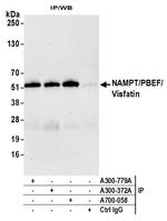 NAMPT/PBEF/Visfatin Antibody in Immunoprecipitation (IP)