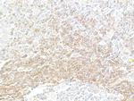 HVEM/TNFRSF14 Antibody in Immunohistochemistry (Paraffin) (IHC (P))