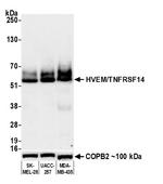 HVEM/TNFRSF14 Antibody in Western Blot (WB)