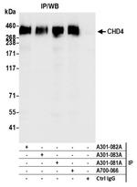 CHD4 Antibody in Immunoprecipitation (IP)