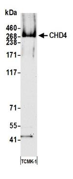 CHD4 Antibody in Western Blot (WB)