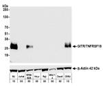 GITR/TNFRSF18 Antibody in Western Blot (WB)