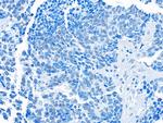 BRD3 Antibody in Immunohistochemistry (Paraffin) (IHC (P))