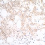 Nectin-2/CD112 Antibody in Immunohistochemistry (Paraffin) (IHC (P))