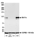 Bcl11a Antibody in Western Blot (WB)