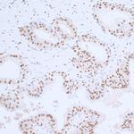 PCNA Antibody in Immunohistochemistry (Paraffin) (IHC (P))