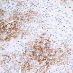 EpCAM Antibody in Immunohistochemistry (Paraffin) (IHC (P))