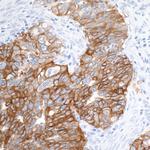 EpCAM Antibody in Immunohistochemistry (Paraffin) (IHC (P))