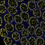 EpCAM Antibody in Immunohistochemistry (Paraffin) (IHC (P))