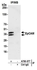 EpCAM Antibody in Immunoprecipitation (IP)